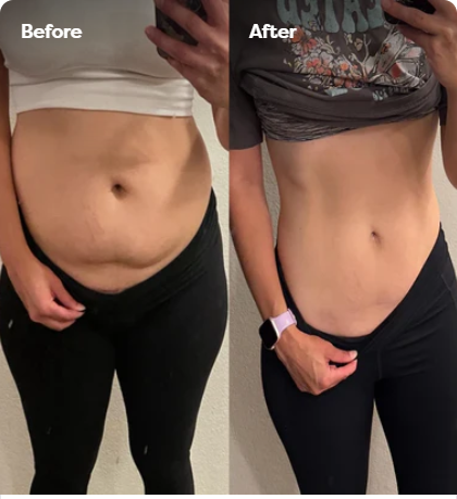 Velina BodySculpt™