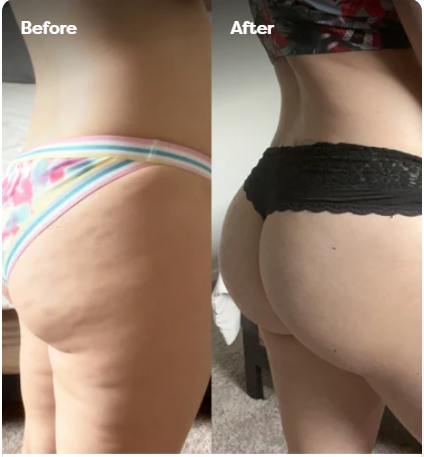 Velina BodySculpt™