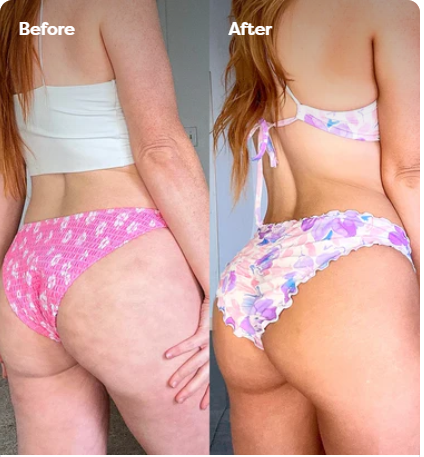 Velina BodySculpt™
