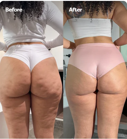 Velina BodySculpt™