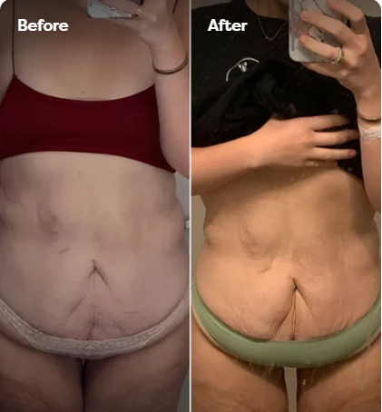 Velina BodySculpt™