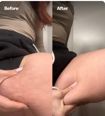 Velina BodySculpt™
