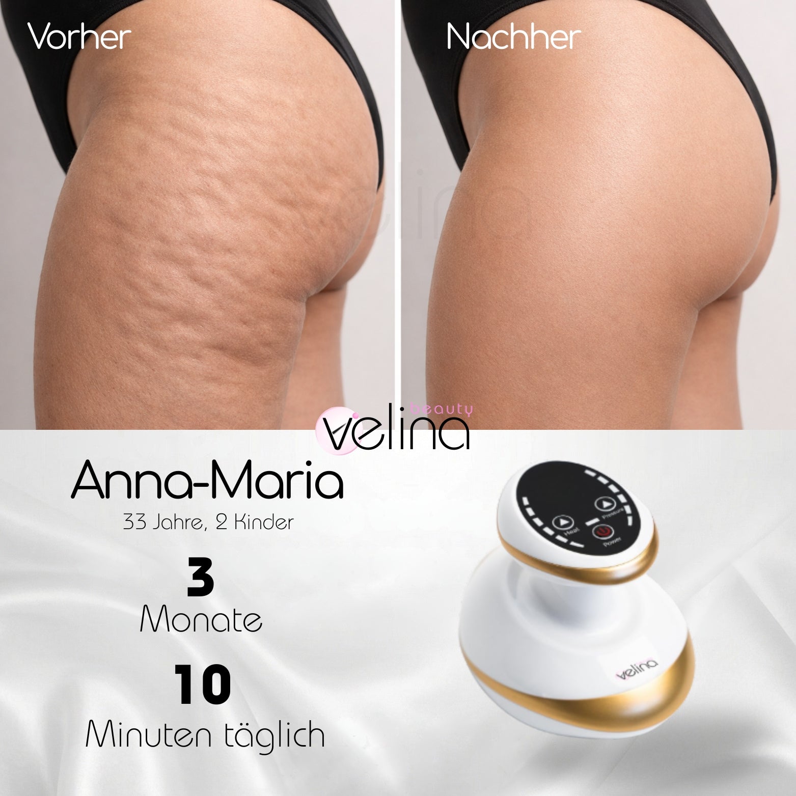 Velina BodySculpt™